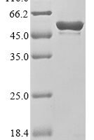 Human Runt-related transcription factor 1 (Runx1) Recombinant Protein - BioCrest Sci