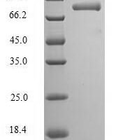 Human Ribonucleoprotein PTB-binding 2 (RAVER2) Recombinant Protein - BioCrest Sci