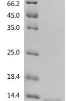 Mouse S100a8/S100a9 Heterodimer protein Recombinant Protein - BioCrest Sci