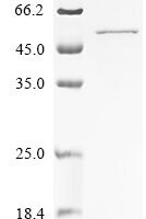 Human Krueppel-like factor 1 (KLF1) Recombinant Protein - BioCrest Sci