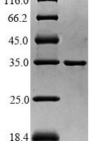 Saccharomyces cerevisiae Ubiquitin-like-specific protease 1 (ULP1), partial Recombinant Protein - BioCrest Sci
