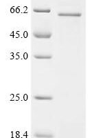 Rat Complement component receptor 1-like protein (Cr1l), partial Recombinant Protein - BioCrest Sci