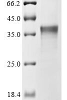 Triticum aestivum Ubiquitin-activating enzyme E1 3 (UBA3), partial Recombinant Protein - BioCrest Sci