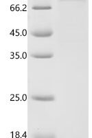 Human Lactotransferrin (LTF) Recombinant Protein, C-His, aa 20–710, Baculovirus - BioCrest Sci