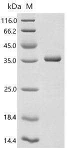 Human Electron transfer flavoprotein subunit beta(ETFB) Recombinant Protein, Homo sapiens (Human), E.coli, C-terminal 6xHis-tagged, 34.6 kDa, purity >≥ 95% as determined by SDS-PAGE.