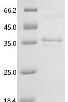 Human Insulin-like growth factor 1 (IGF1) Recombinant Protein - BioCrest Sci