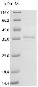Human Insulin-like growth factor 1 (IGF1) Recombinant Protein, Homo sapiens (Human), Mammalian cell, N-terminal hFc1-tagged, 33.7 kDa, purity >≥ 90% as determined by SDS-PAGE.