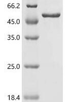 Human Paired box protein Pax-2 (PAX2), partial Recombinant Protein, C-His - BioCrest Sci
