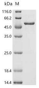 Human Paired box protein Pax-2 (PAX2), partial Recombinant Protein, C-His, E.coli, C-terminal 6xHis-tagged, 47.8 kDa, purity >≥ 95% as determined by SDS-PAGE.