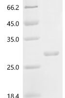 Ricinus communis Ricin, partial Recombinant Protein, Tag-Free - BioCrest Sci