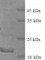 Human Cancer/testis antigen 1 (CTAG1A) Recombinant Protein, N-His - BioCrest Sci