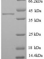 Human Histone H2A.J (H2AFJ) Recombinant Protein - BioCrest Sci
