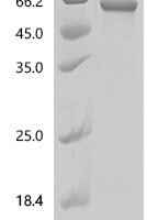 Human Keratin, type II cuticular Hb5 (KRT85) Recombinant Protein, N-His, aa 1–507, E.coli - BioCrest Sci