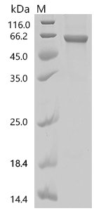 Human Keratin, type II cuticular Hb5 (KRT85) Recombinant Protein, N-His, aa 1–507, E.coli, Homo sapiens (Human), E.coli, N-terminal 6xHis-tagged, 62.7 kDa, purity >≥ 85% as determined by SDS-PAGE.
