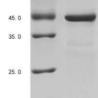 Human Fibrinogen-like protein 1 (FGL1), partial Recombinant Protein - BioCrest Sci