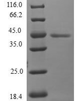 Human Mitochondrial fission process protein 1 (MTFP1) Recombinant Protein - BioCrest Sci