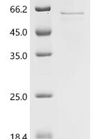 Human Coiled-coil domain-containing protein 112 (CCDC112 ) Recombinant Protein - BioCrest Sci