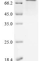 Human Lactotransferrin (LTF) Recombinant Protein, C-10His - BioCrest Sci