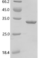 Escherichia coli Trehalose-6-phosphate phosphatase (otsB) Recombinant Protein, N-His - BioCrest Sci