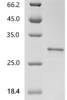 Human Peroxiredoxin-6 (PRDX6) Recombinant Protein, N-10His - BioCrest Sci