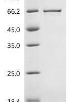 Human Cerebellar degeneration-related protein 2-like (CDR2L) Recombinant Protein, C-His, aa 1–465, E.coli - BioCrest Sci