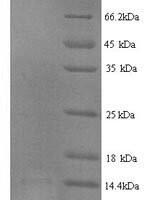Rat Type-2 angiotensin II receptor (Agtr2), partial Recombinant Protein, N-His - BioCrest Sci