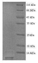 Rat Type-2 angiotensin II receptor (Agtr2), partial Recombinant Protein, N-His, Rattus norvegicus (Rat), Yeast, N-terminal 6xHis-tagged, 6.9 kDa, purity >≥ 90% as determined by SDS-PAGE.
