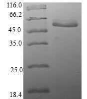 Human Translation initiation factor eIF-2B subunit alpha (EIF2B1) Recombinant Protein - BioCrest Sci