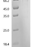 Human Urokinase-type plasminogen activator (PLAU), partial Recombinant Protein, C-hFc1 - BioCrest Sci