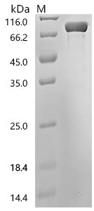 Human Urokinase-type plasminogen activator (PLAU), partial Recombinant Protein, C-hFc1, Homo sapiens (Human), Mammalian cell, C-terminal hFc1-tagged, 75.3 kDa, purity >≥ 95% as determined by SDS-PAGE.