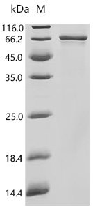 Human Cytochrome P450 1B1 (CYP1B1) Recombinant Protein, Homo sapiens (Human), E.coli, C-terminal 6xHis-tagged, 67.8 kDa, purity >≥ 90% as determined by SDS-PAGE.