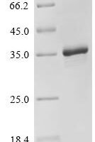 Human Protein mono-ADP-ribosyltransferase PARP16 (PARP16), partial Recombinant Protein - BioCrest Sci