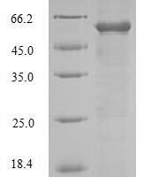 Mouse Disintegrin and metalloproteinase domain-containing protein 12 (Adam12), partial Recombinant Protein, N-10His/C-Myc, aa 206–706, Baculovirus - BioCrest Sci