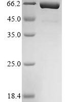 Mouse Interleukin-11 (Il11),Biotinylated Recombinant Protein - BioCrest Sci