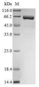 Mouse Interleukin-11 (Il11),Biotinylated Recombinant Protein, Mus musculus (Mouse), E.coli, N-terminal MBP-tagged and C-terminal 6xHis-Avi-tagged, 66.9 kDa, purity >≥ 85% as determined by SDS-PAGE.