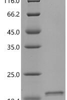 Sheep Fibroblast growth factor 2 (FGF2) Recombinant Protein, C-His - BioCrest Sci