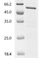 Human Sequestosome-1 (SQSTM1) Recombinant Protein - BioCrest Sci