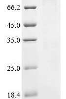 Human Cyclin-T1 (CCNT1) Recombinant Protein - BioCrest Sci