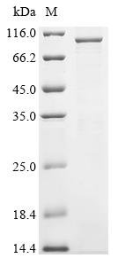 Human Cyclin-T1 (CCNT1) Recombinant Protein, Homo sapiens (Human), E.coli, N-terminal 6xHis-tagged, 86.7 kDa, purity >≥ 85% as determined by SDS-PAGE.
