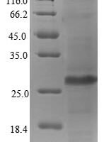 Human cytomegalovirus 65 kDa phosphoprotein (UL83), partial Recombinant Protein - BioCrest Sci