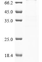 Mouse Ribosomal protein S6 kinase alpha-4 (Rps6ka4) Recombinant Protein, N-10His/C-Myc - BioCrest Sci