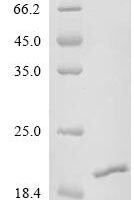 Mycobacterium tuberculosis ESAT-6-like protein EsxK (esxK) Recombinant Protein, C-His - BioCrest Sci
