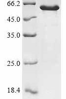 Human Protein phosphatase 1 regulatory subunit 3G (PPP1R3G) Recombinant Protein - BioCrest Sci