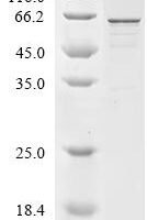 Mouse Ras GTPase-activating protein-binding protein 1 (G3bp1) Recombinant Protein - BioCrest Sci