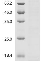 Mouse Mas-related G-protein coupled receptor member B2 (Mrgprb2), partial Recombinant Protein, C-His - BioCrest Sci