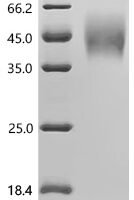 Macaca fascicularis Interleukin-22 receptor subunit alpha-2 (IL22RA2) Recombinant Protein - BioCrest Sci