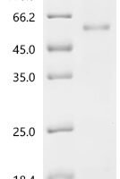Human Fibulin-7 (FBLN7) Recombinant Protein, C-His, aa 25–439, E.coli - BioCrest Sci