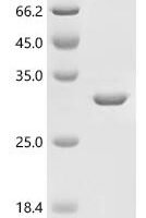 Bovine leukemia virus Gag polyprotein (gag), partial Recombinant Protein - BioCrest Sci