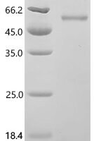 Hantaan virus Envelopment polyprotein (GP), partial Recombinant Protein, C-His - BioCrest Sci