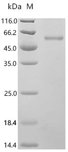 Hantaan virus Envelopment polyprotein (GP), partial Recombinant Protein, C-His, Hantaan virus (strain Lee) (Lee virus) (Korean hemorrhagic fever virus), E.coli, C-terminal 6xHis-tagged, 58.3 kDa, purity >≥ 85% as determined by SDS-PAGE.